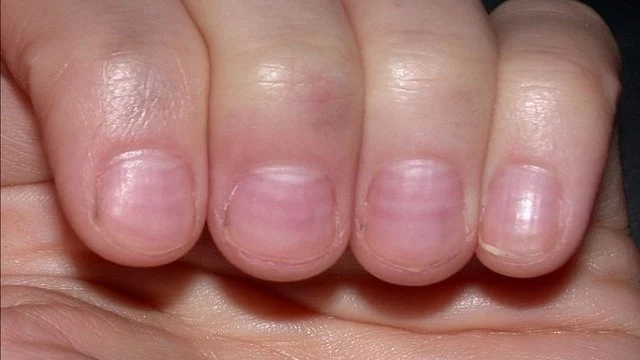 Полумесяцем или с уголками: как правильно стричь ногти? — новости медицины